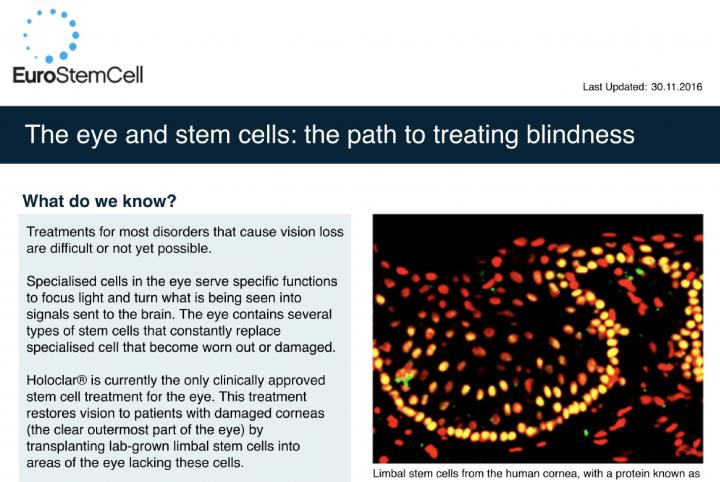 Night Blindness Ppt BLINDS